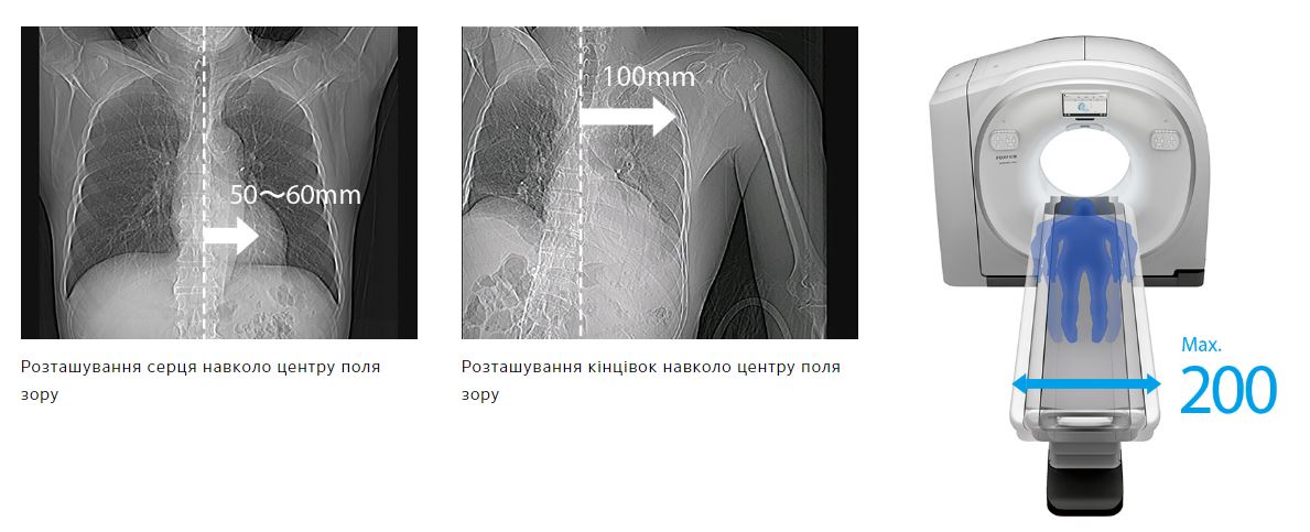 Купить Компьютерный томограф FUJIFILM Scenaria View (128 срезов) Компьютерный томограф FUJIFILM Scenaria View (128 срезов)