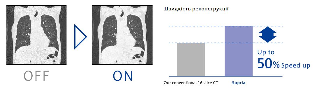 Купити Комп’ютерний томограф FUJIFILM Supria 32 (16/32 зрізи) Комп'ютерний томограф FUJIFILM Supria 32 (16/32 зрізи)